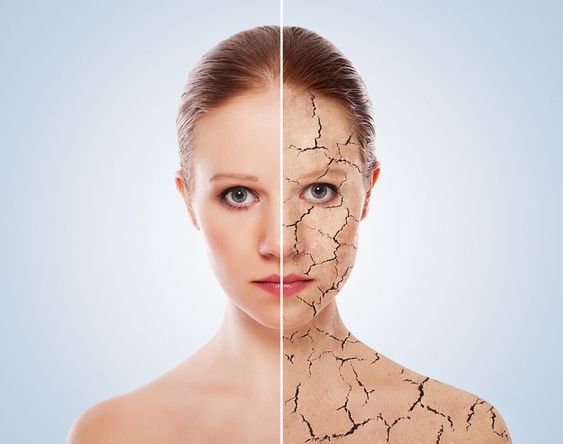 Da mặt nẻ mốc: Nguyên nhân và cách khắc phục